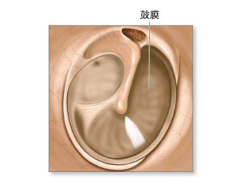 鼓膜穿孔怎么治疗?治疗方法有哪些