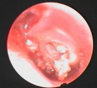 �ж��׵�֢״������