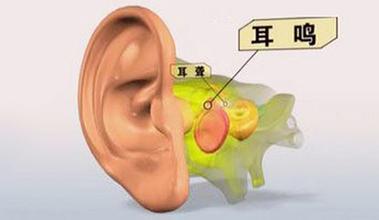耳鸣是由哪些因素引起